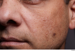 Face Mouth Nose Cheek Skin Man Birthmarks Chubby Studio photo references